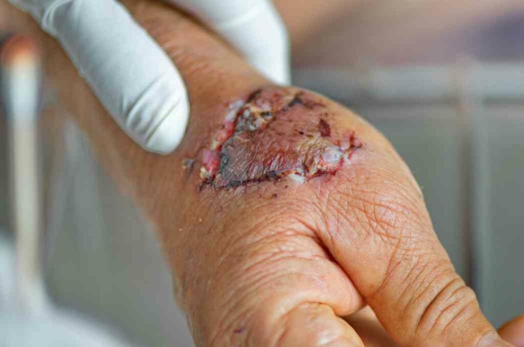 Fastest Way To Heal Dog Bite